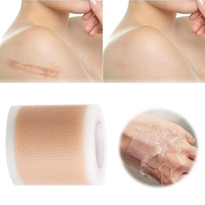 Silicone Scar Skin Repair Stretch Mark Removal
