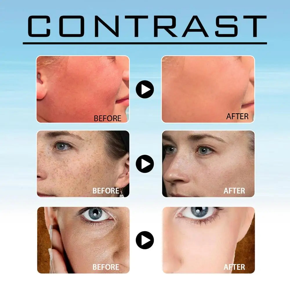 24pcs Sunscreen Face Nose Patch UV Protection Patch Summer Outdoor Cool Sunscreen Sticker Golf Gel Facial Patches